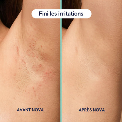 Rasoir 5 en 1 NOVA