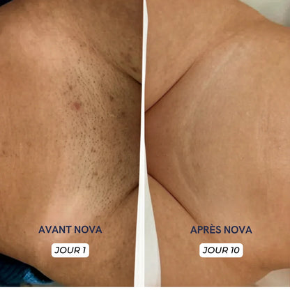 Rasoir 5 en 1 NOVA