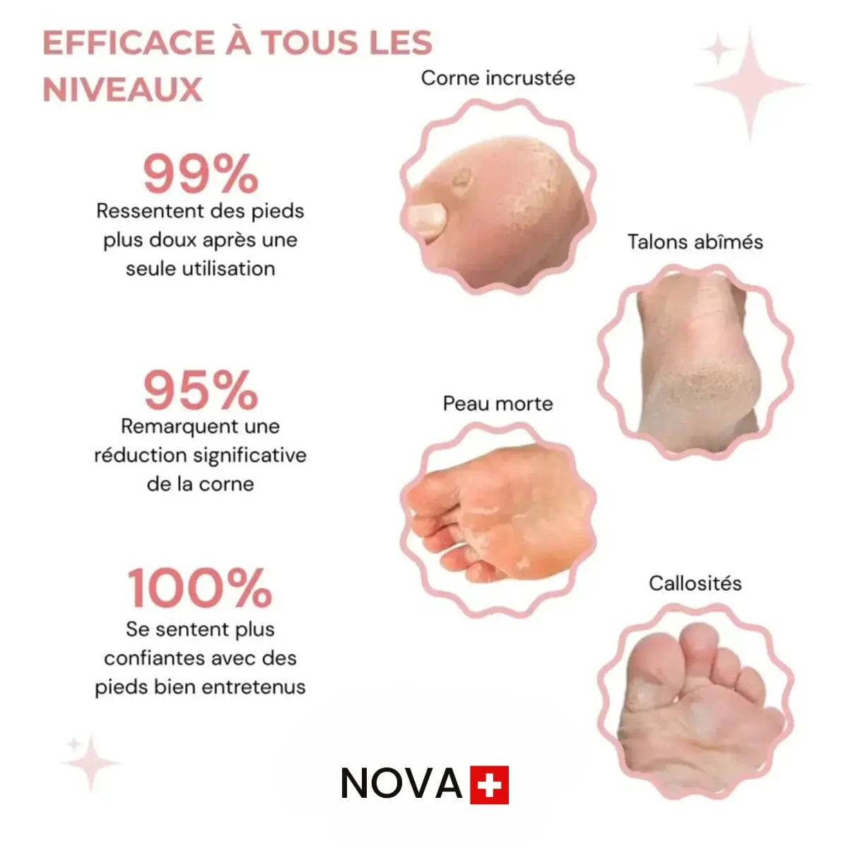 Nova Suisse™ - Kit di bellezza per i piedi
