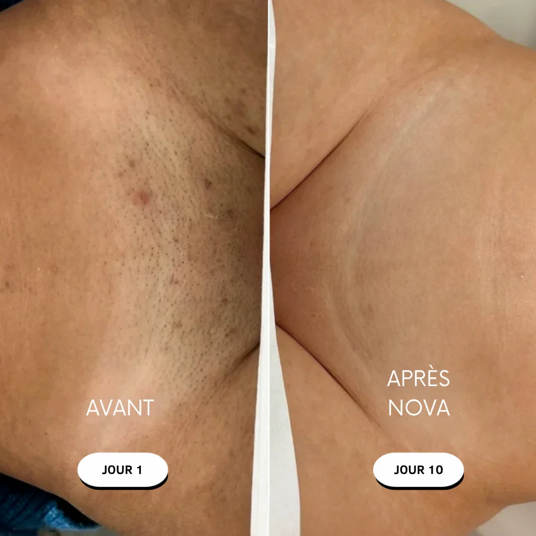 Rasoir 5 en 1 NOVA