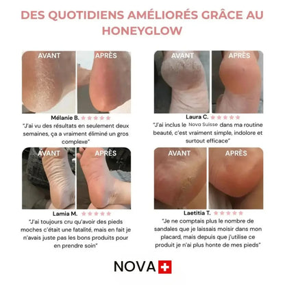 Nova Suisse™ - Kit di bellezza per i piedi