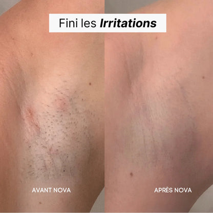 Rasoir 5 en 1 NOVA