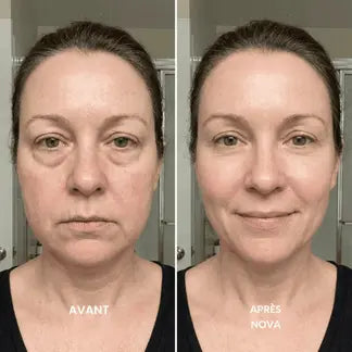 Nova - Spazzola per il drenaggio linfatico del viso