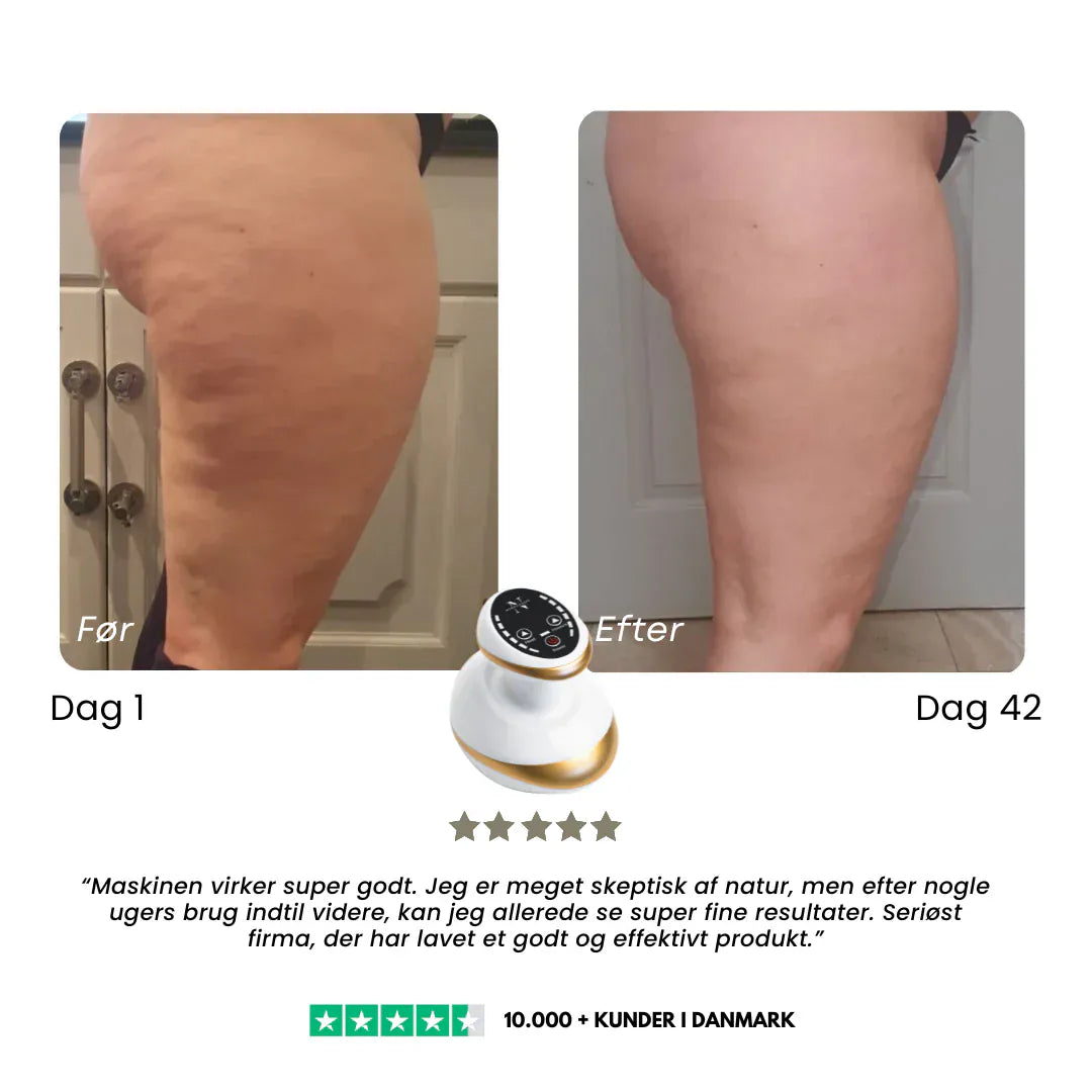 Nova – Apparecchio per massaggi