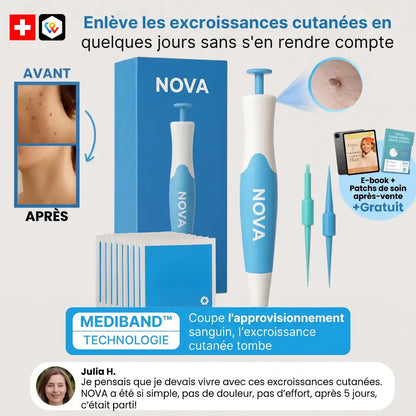 Nova Élimination des Acrochordons