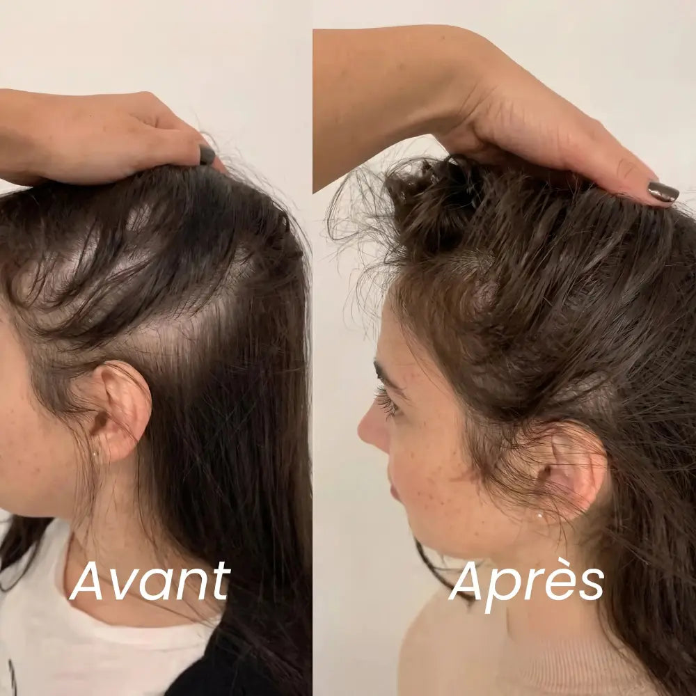 Sérum roll-on pour la pousse des cheveux