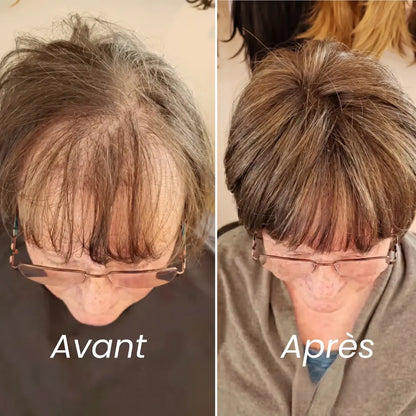 Sérum roll-on pour la pousse des cheveux