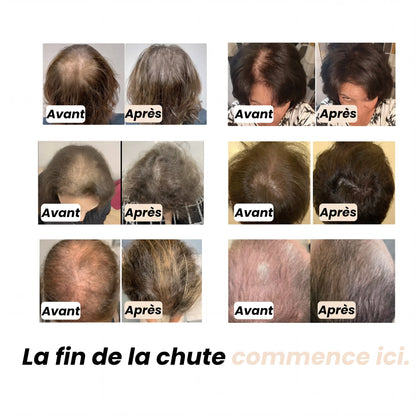 Sérum roll-on pour la pousse des cheveux