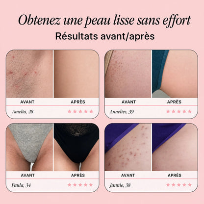OriginalRazor – 10 lames de rechange offertes temporairement