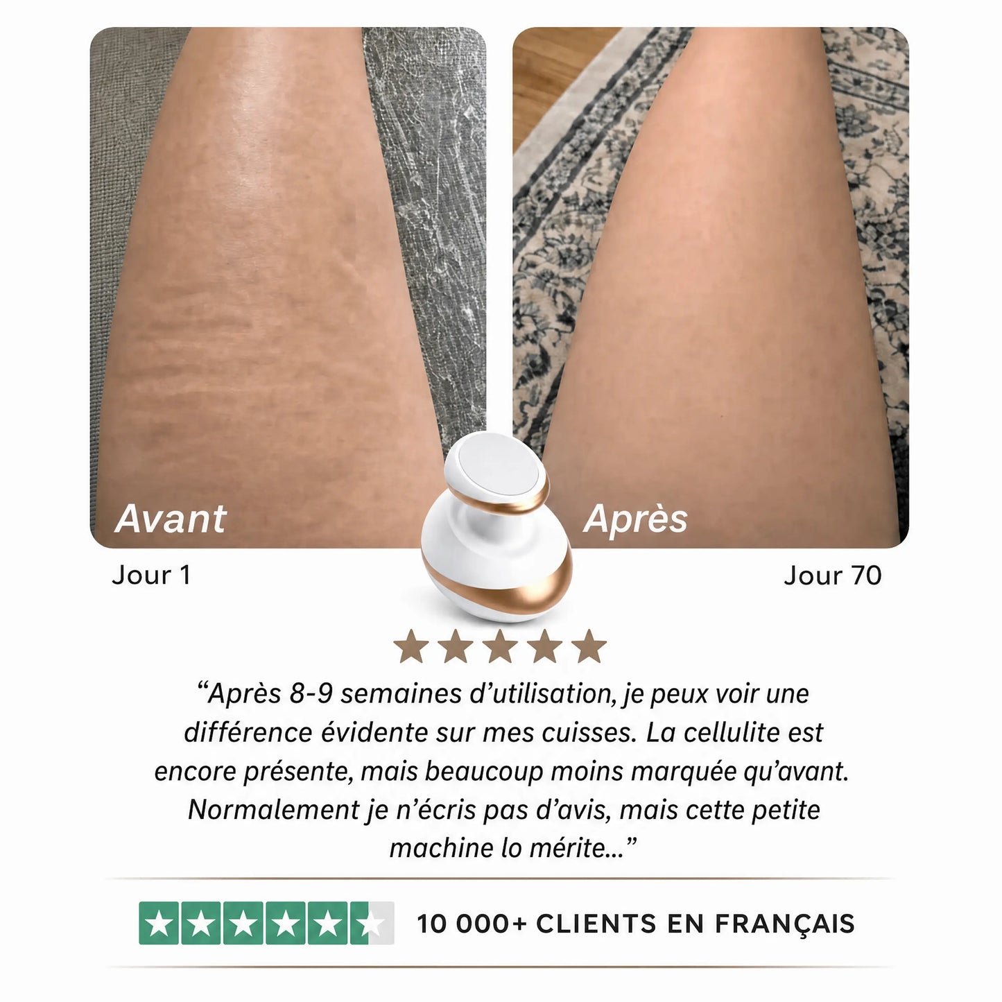 Dispositif 4-en-1 traitement de la cellulite