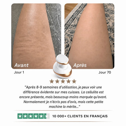 Dispositif 4-en-1 traitement de la cellulite