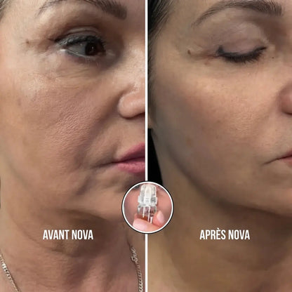 Sistema di microinfusione Nova