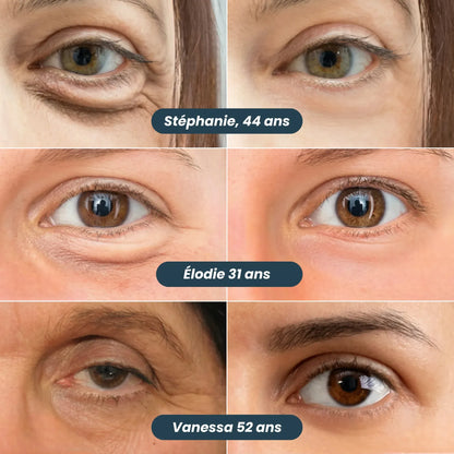 Patch anti-occhiaie di nuova generazione